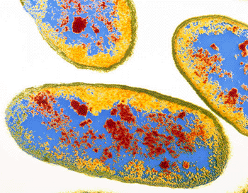 Imagen: Microfotografía electrónica de transmisión en color de cortes finos con células de la bacteria Aeromonas hydrophila (Fotografía cortesía del Dr. Kari Lounatmaa / SPL).